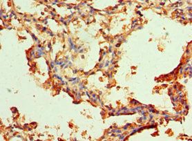 SERPINA3 antibody