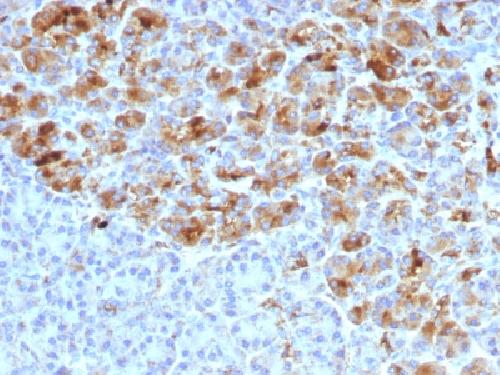 Alpha-1-Antichymotrypsin (SERPINA3) (Histiocytoma Marker) Antibody