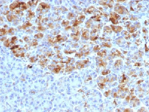 SERPINA3 antibody