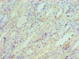 SERPINA6 Antibody
