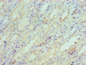 SERPINA6 antibody