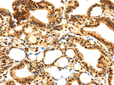 SERPINB1 Antibody