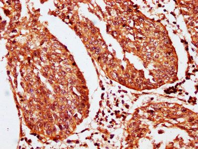 SERPINB2 Antibody