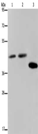 SERPINB3 antibody