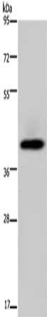 SERPINB3 Antibody