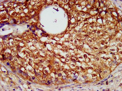 SERPINB4 Antibody
