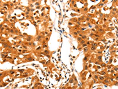 SERPINB5 antibody