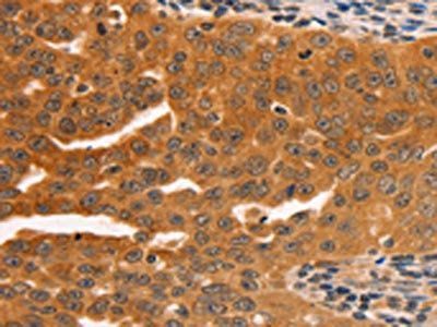 SERPINB5 Antibody