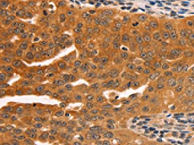 SERPINB5 antibody