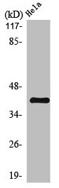 SERPINB5 Antibody