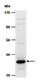 SERPINB5 (N3) Antibody, Rabbit Polyclonal