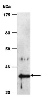SERPINB5 (N1) Antibody, Rabbit Polyclonal