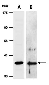SERPINB5 (vPairTM) Antibodies