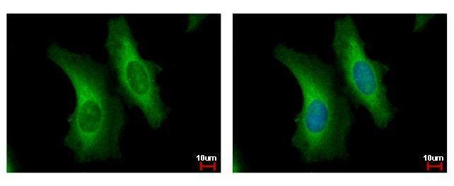 SERPINB6 antibody [N2C2], Internal