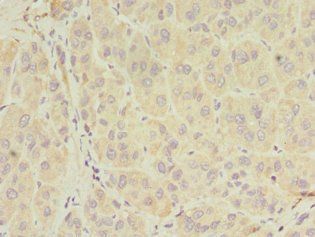 SERPIND1 Antibody