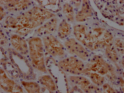 SERPINE1 Recombinant Monoclonal Antibody