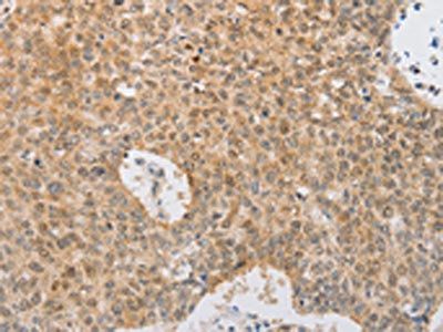 SERPINE2 Antibody