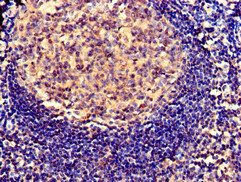 SERPING1 antibody