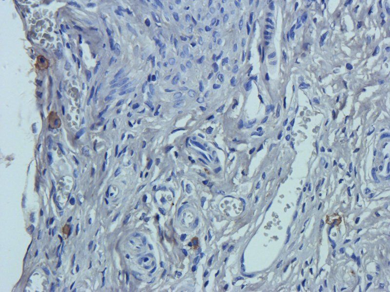 SERPING1 antibody