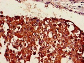 SESN1 Antibody