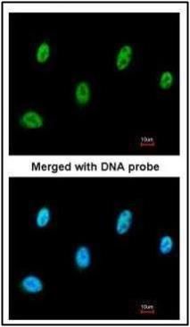 SESN3 Rabbit Polyclonal Antibody