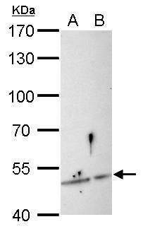SESN3 Rabbit Polyclonal Antibody