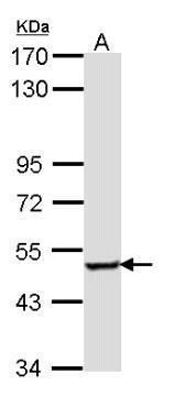 SESN3 Rabbit Polyclonal Antibody