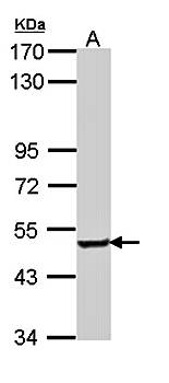 SESN3 antibody