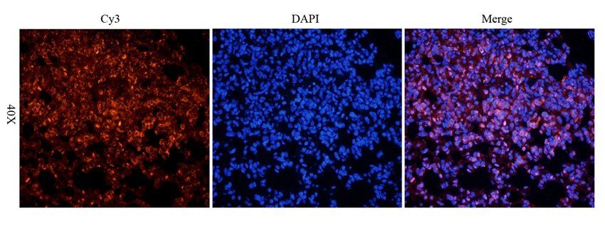 SET Rabbit Polyclonal Antibody