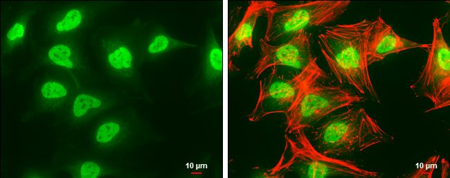 SET Rabbit Polyclonal Antibody