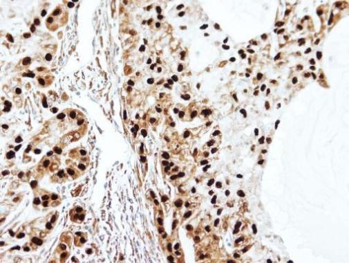 SET Rabbit Polyclonal Antibody