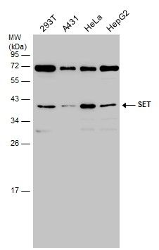 SET Rabbit Polyclonal Antibody