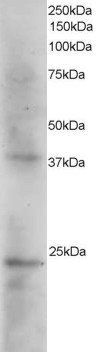Goat anti-SET / I2 alpha PP2A Antibody