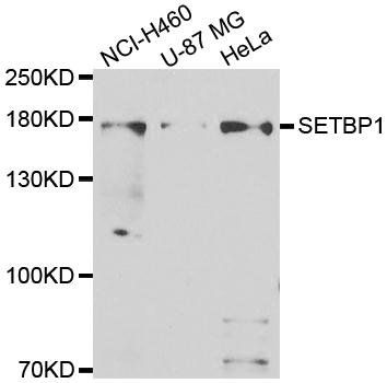 SETBP1 antibody