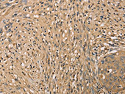 SETD2 Antibody