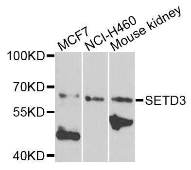 SETD3 antibody