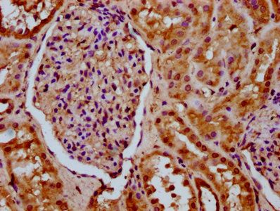 SETD6 Antibody