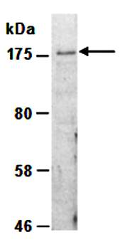 SETDB1 antibody