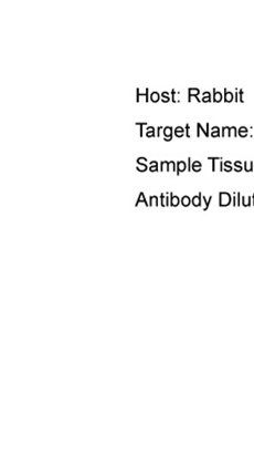 SETMR antibody
