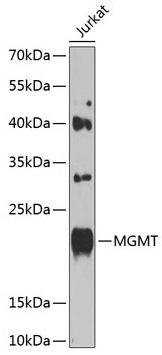 MGMT antibody