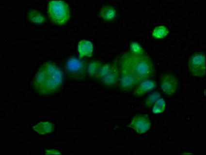 SEZ6L2 antibody