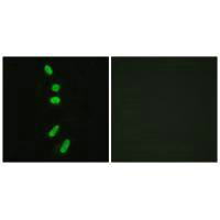 SF1 (Ab-82) Antibody