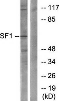SF1 (Ab-82) Antibody