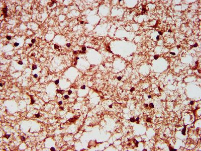 SF3B1 Antibody