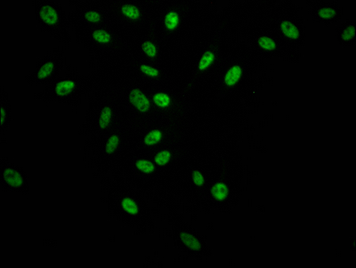 SF3B1 Recombinant Monoclonal Antibody