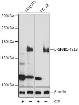SF3B1 (Phospho-T313) antibody