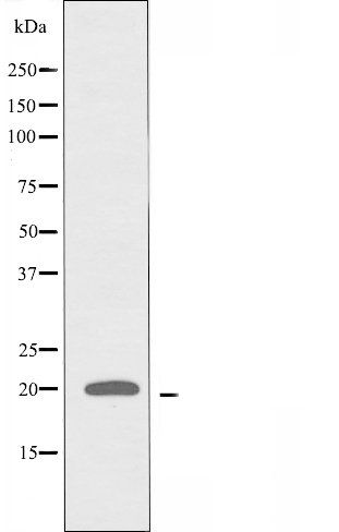 SF3B14 antibody