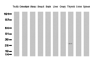 SF3B14 Antibody