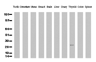 SF3B14 (SF3B6) antibody