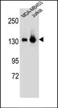 SF3B3 antibody